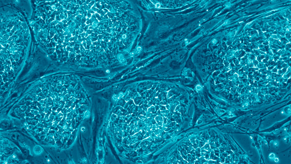 featured image for Unraveling the mysteries of stem cells