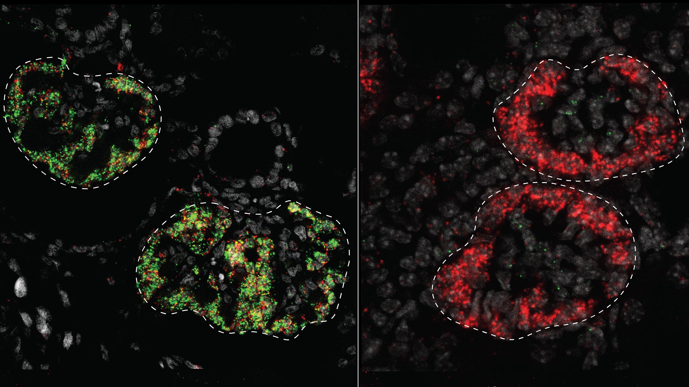 featured image for Study maps how genes instruct kidneys to develop differently in mice and humans