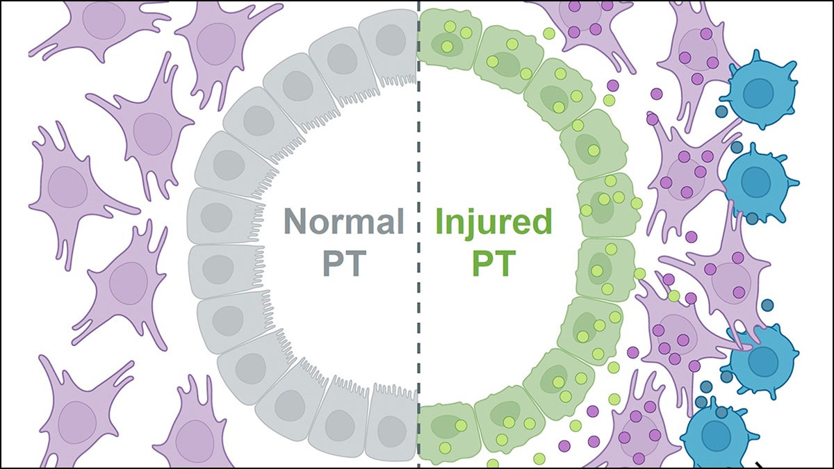 featured image for Study shows cells get involved in unhealthy relationships after acute kidney injury in lab subjects