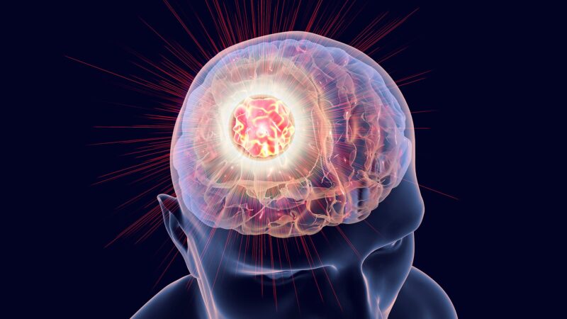 featured image for Could electric fields supercharge immune attack on the deadliest form of brain cancer?