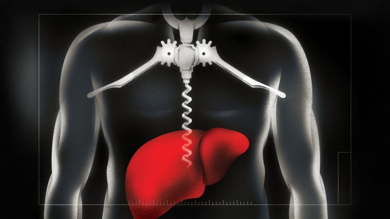 featured image for USC doctors are leading treatment of the post-COVID rise in alcohol-related liver disease